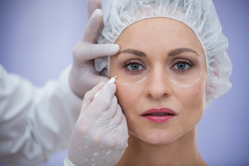 Eye Fillers in Corpus Christi