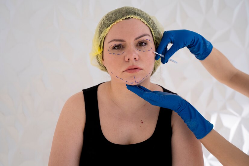 Laser Skin Resurfacing Corpus Christi TX
